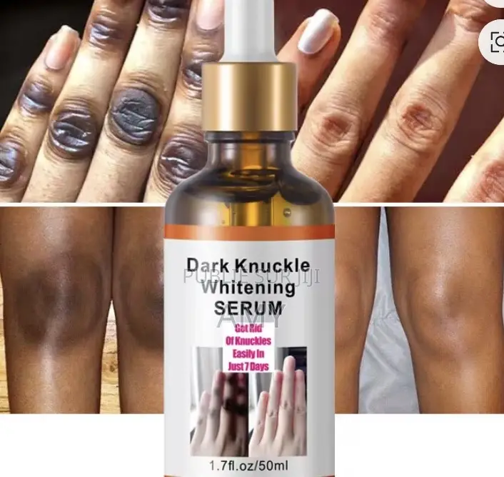 Produit Pour Quintaux