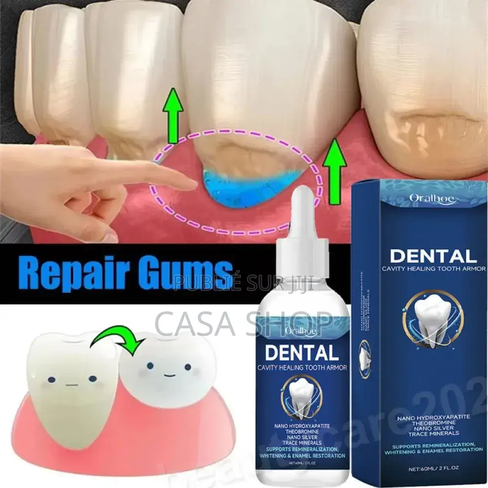 Dental Dents