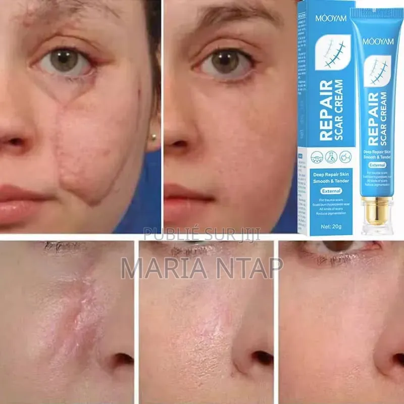 Crème Anti Cicatrice Efficace