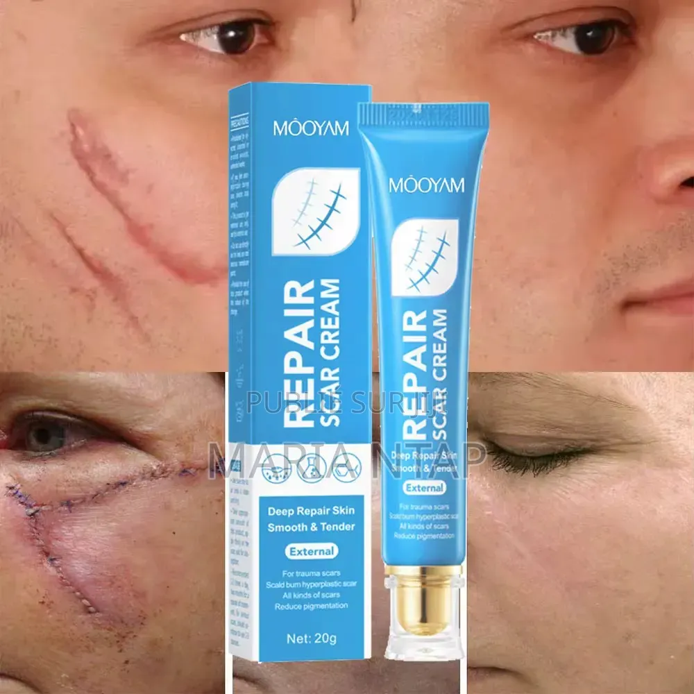 Crème Anti Cicatrice Efficace