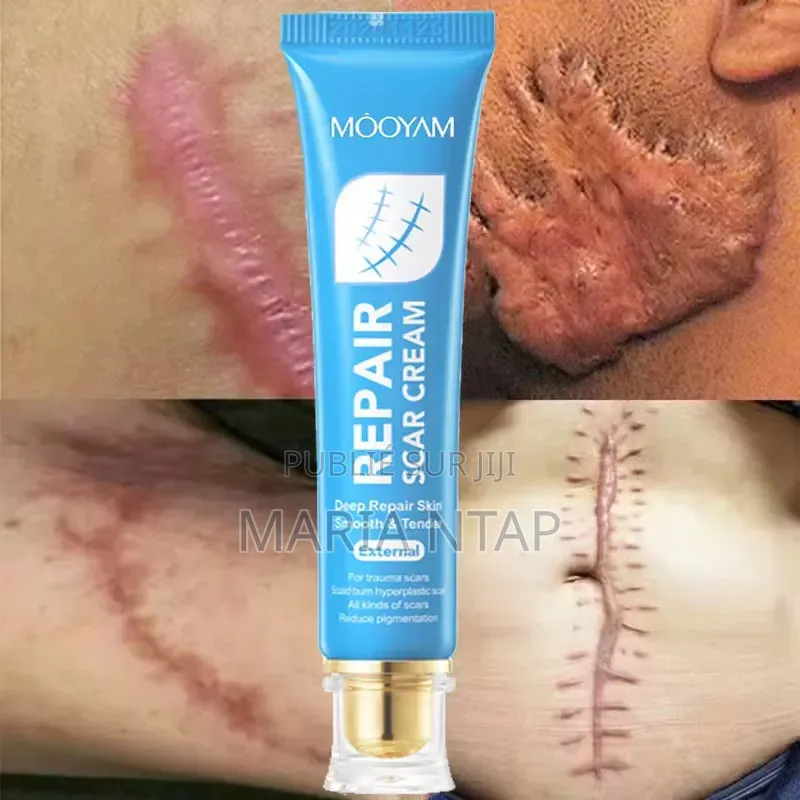 Crème Anti Cicatrice Efficace