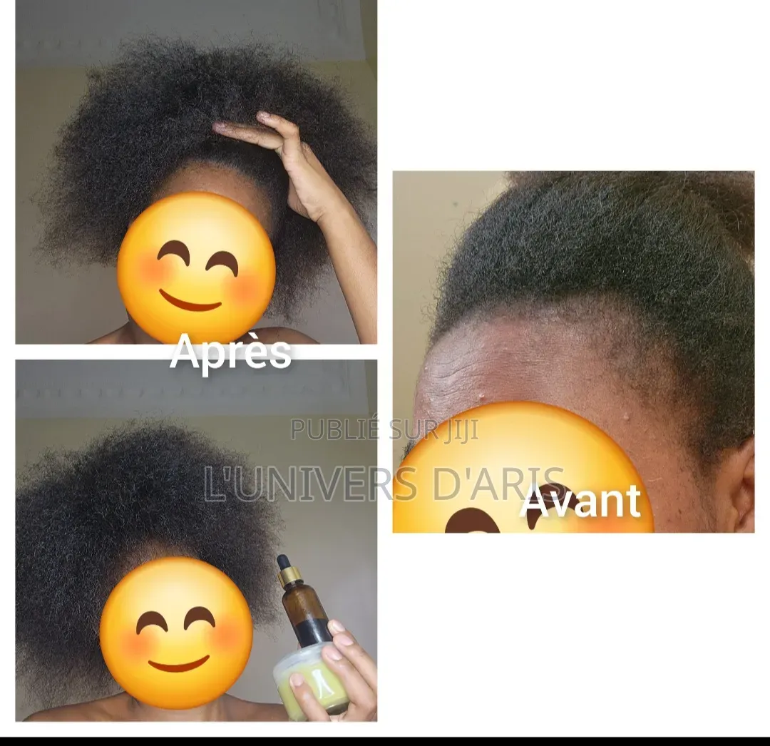 Gamme Capillaire Pousse