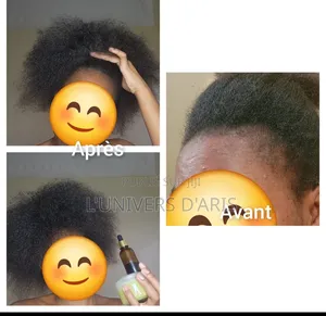 Gamme Capillaire Pousse