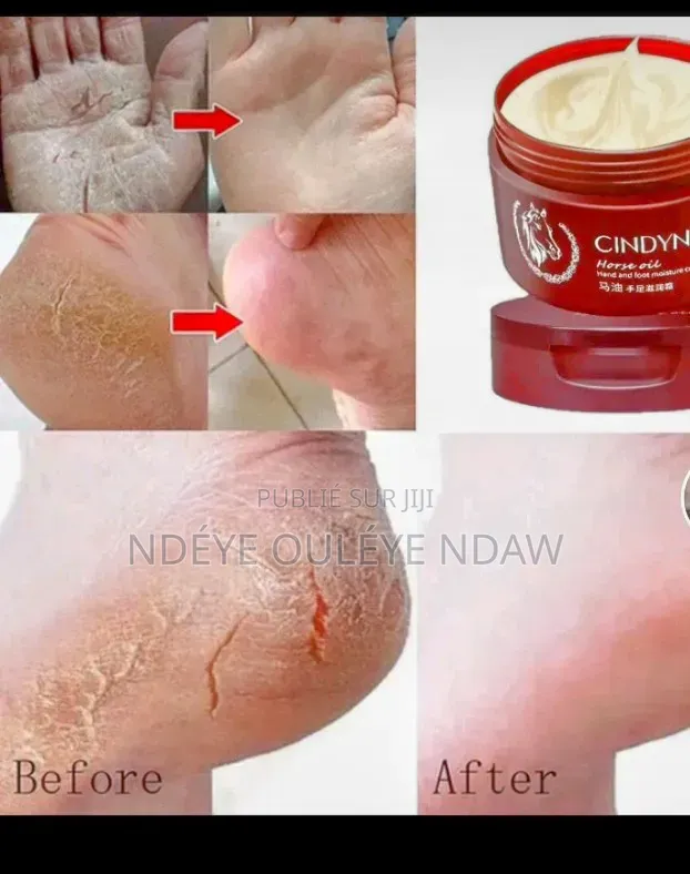 Creme Main Et Pieds