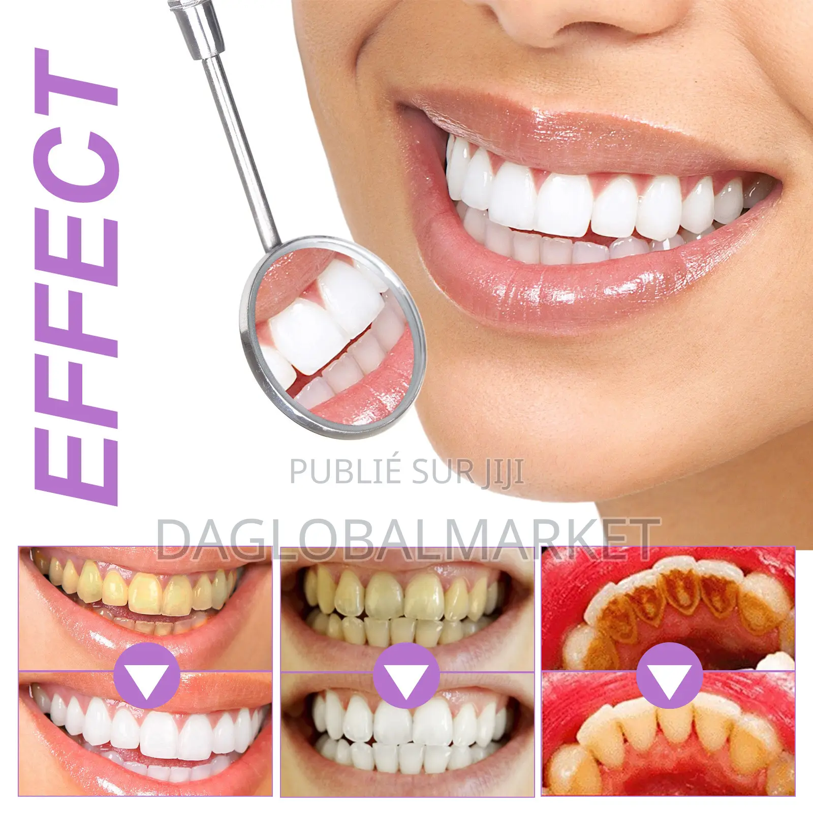 Blanchiment Des Dents Violettes Pour Les Dents Sensibles Bandes