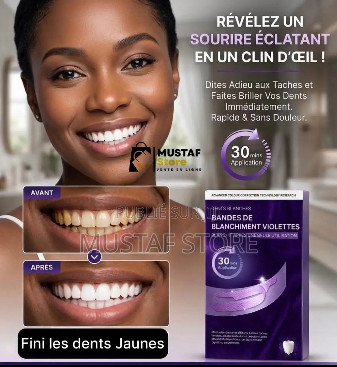 Blanchiment Dentaire