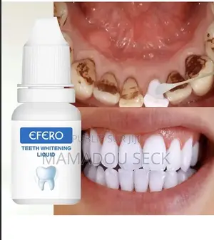 Efero Kit Blanchiment Dentaire