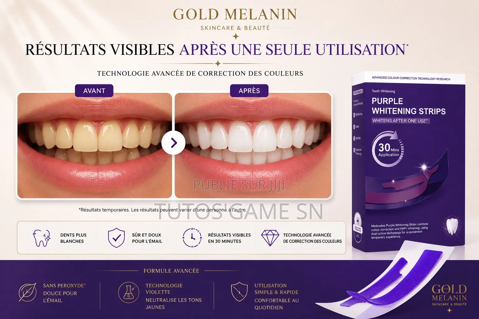 Patch Blanchiment Dentaire