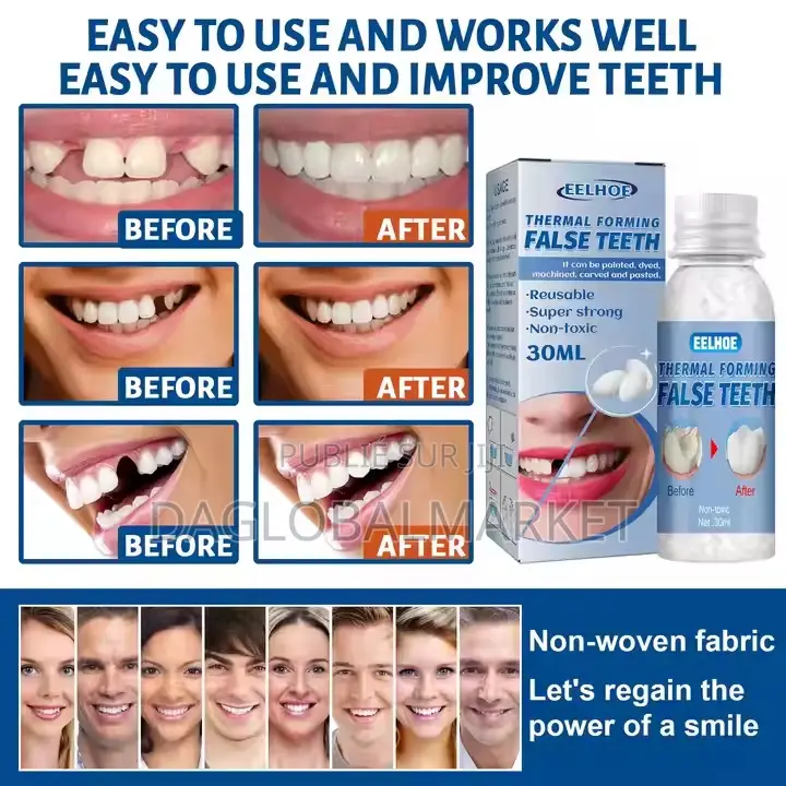 Colle Dentaire Temporaire Pour Modification Des Dents,