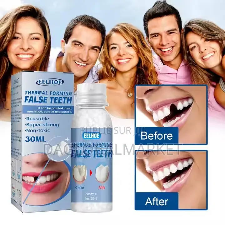 Colle Dentaire Temporaire Pour Modification Des Dents,