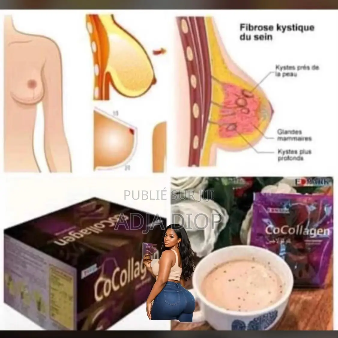 Cocollagen
