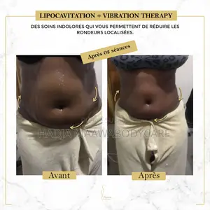 Affinez Votre Silhouette Sans Chirurgie