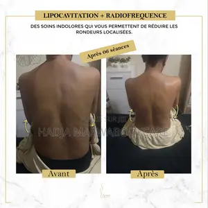 Affinez Votre Silhouette Sans Chirurgie