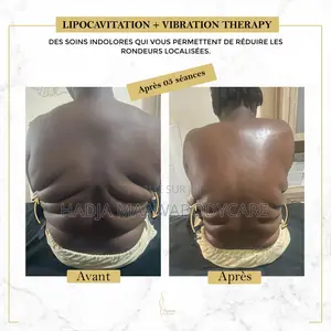 Affinez Votre Silhouette Sans Chirurgie