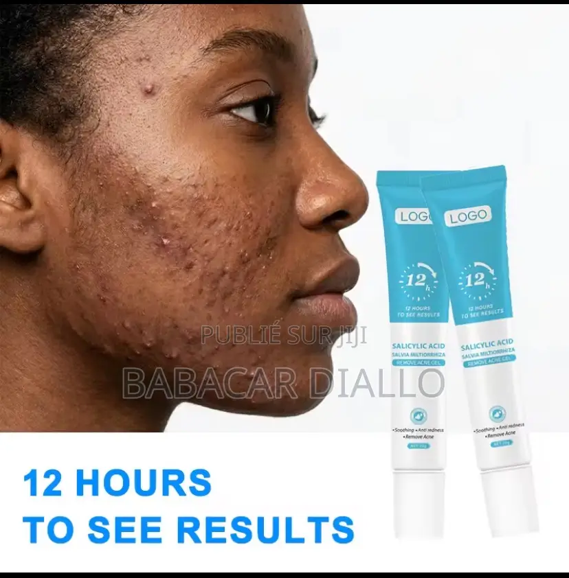 Gel Anti Acné Et Tâches