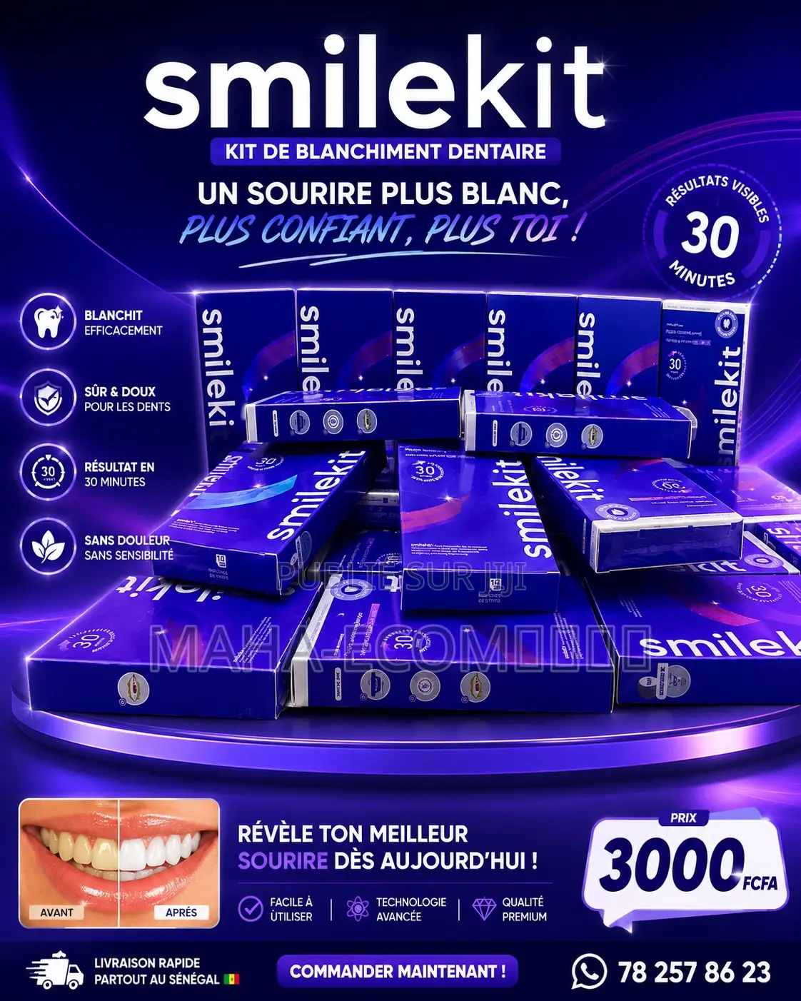 Blanchiment Dentaire