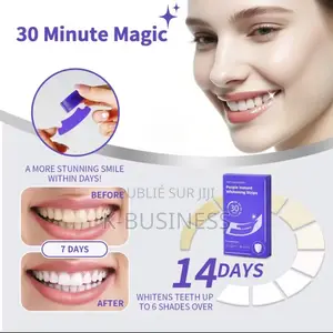 Smile Kit – Bandes Blanchissantes Violettes